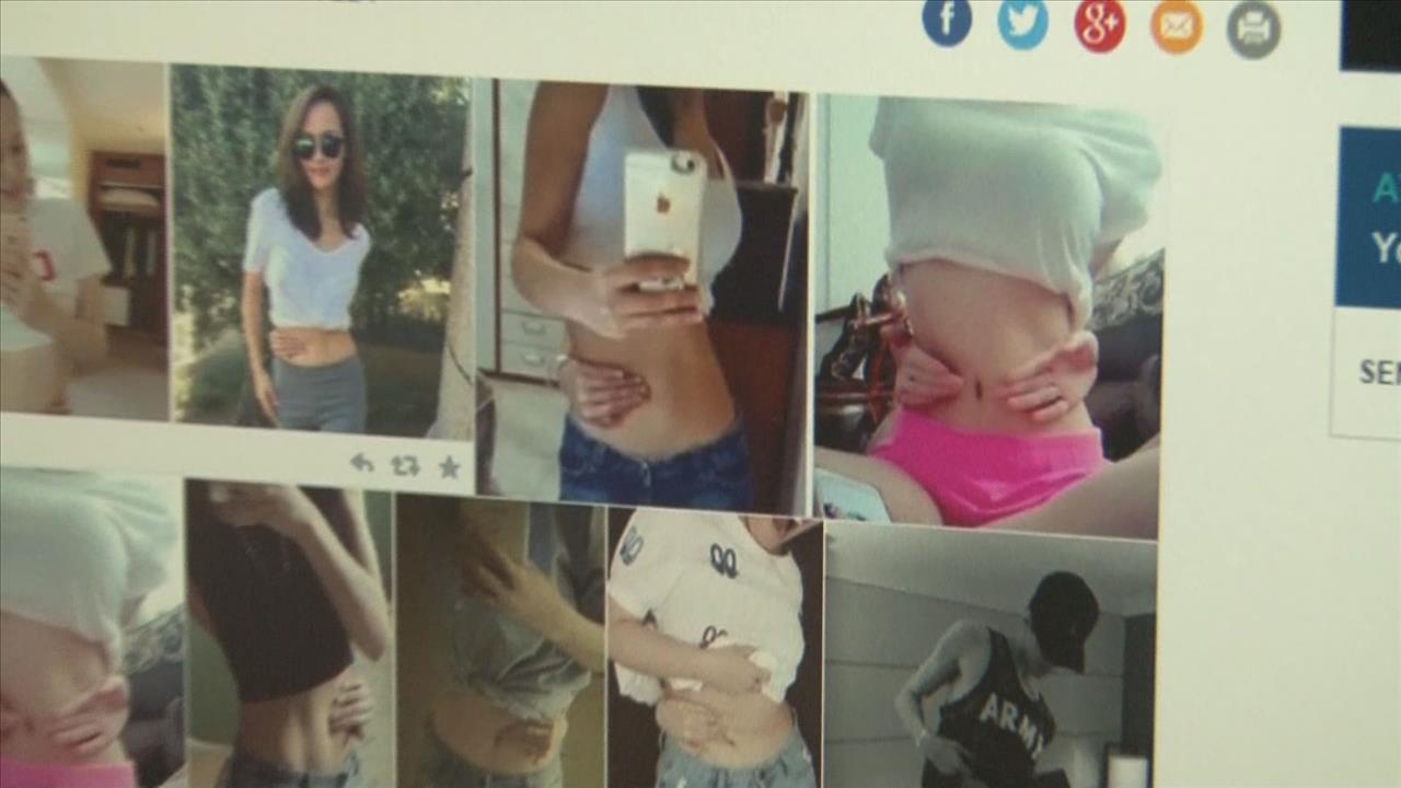 Belly button challenge promotes unhealthy body image | kare11.com