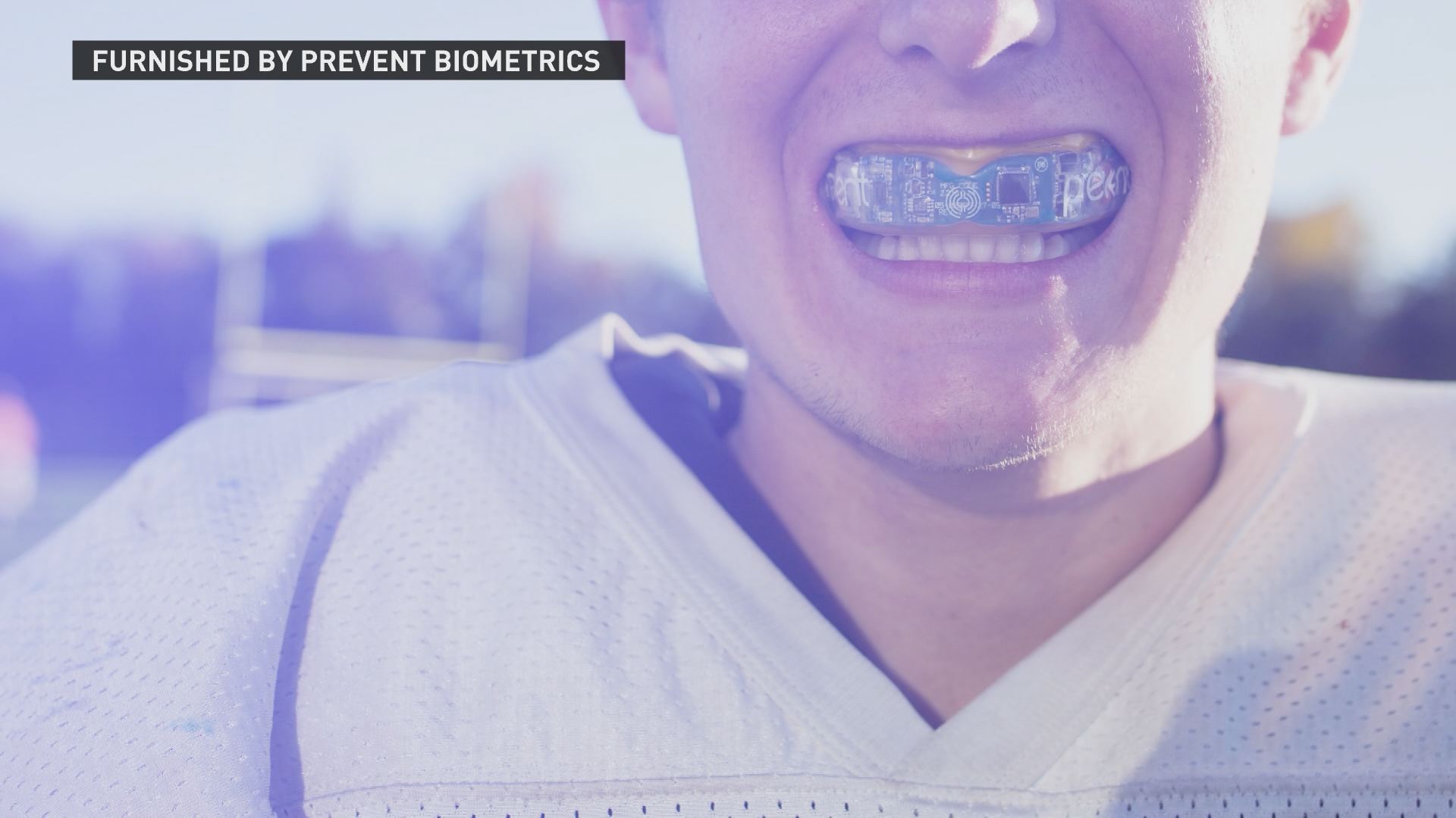 Mouth guard to detect concussion hits